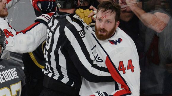 Apparently, Brooks Orpik Lost a Finger During the Stanley Cup Finals