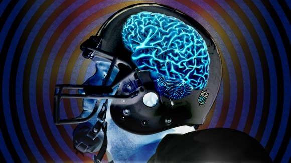 CTE Research Breakthrough: They Can Test Living Players