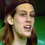Olynyk Proves His Hoser Chops, then Breaks the Hoser Code