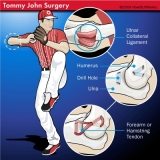 Braves' Medlen Gets Tommy John 2.0; Ervin Santana Gets a Job
