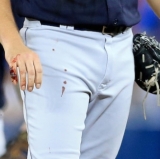 Trevor Bauer Almost Bleeds Out on the Mound