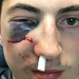 Zach Werenski: The Face of Stanley Cup Intensity