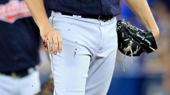 Trevor Bauer Almost Bleeds Out on the Mound